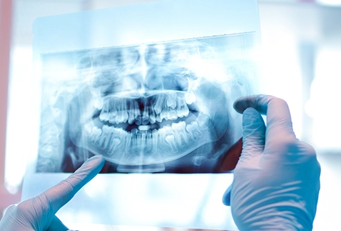 znieczulenie stomatologiczne kobieta w masce gazowego znieczulenia dentystycznego